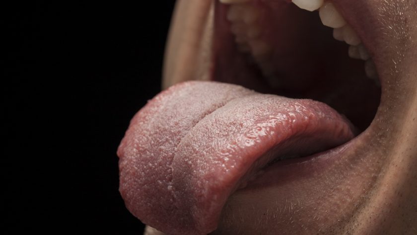 5 Fakta Menarik tentang Sariawan, Gak Cuma Gegera Kurang Vit-C